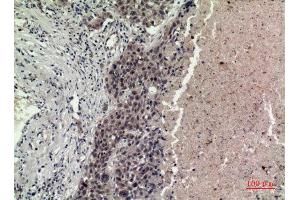 Immunohistochemistry (IHC) analysis of paraffin-embedded Human Lung, antibody was diluted at 1:100. (FGF16 抗体  (Internal Region))