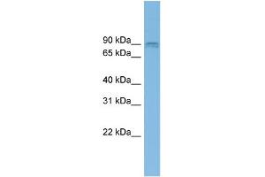 WB Suggested Anti-CENTG1 Antibody Titration: 0. (AGAP2 抗体  (Middle Region))