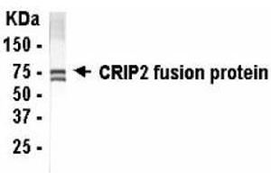 Western Blotting (WB) image for anti-Cysteine-Rich Protein 2 (CRIP2) (AA 1-208) antibody (ABIN2467798) (CRIP2 抗体  (AA 1-208))