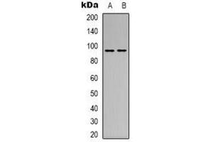 Western blot analysis of CD100 expression in MCF7 (A), L929 (B) whole cell lysates. (SEMA4D/CD100 抗体  (N-Term))