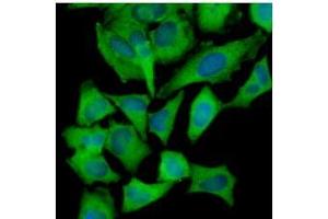 Immunofluorescence (IF) image for anti-Hexokinase 1 (HK1) (AA 1-917), (N-Term) antibody (ABIN317095) (Hexokinase 1 抗体  (N-Term))
