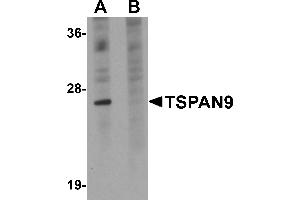 Western Blotting (WB) image for anti-Tetraspanin 9 (TSPAN9) (Middle Region) antibody (ABIN1031151) (Tetraspanin 9 抗体  (Middle Region))