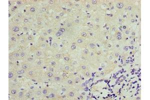 Immunohistochemistry (IHC) image for anti-Transient Receptor Potential Cation Channel, Subfamily M, Member 2 (TRPM2) (AA 60-119) antibody (ABIN7172859)