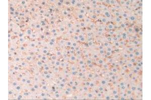 IHC-P analysis of Rat Liver Tissue, with DAB staining. (SERPINA10 抗体  (AA 278-425))