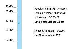 Western Blotting (WB) image for anti-DnaJ (Hsp40) Homolog, Subfamily B, Member 7 (DNAJB7) (C-Term) antibody (ABIN2774028) (DNAJB7 抗体  (C-Term))