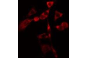 ABIN6275806 staining  Hela cells by IF/ICC. (CYP1B1 抗体  (Internal Region))