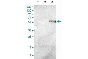 Western Blot analysis of Lane 1: RT-4 cell, Lane 2: U-251 MG sp cell and Lane 3: human plasma tissue (IgG/HSA depleted) lysates with ZMPSTE24 polyclonal antibody . (ZMPSTE24 抗体)