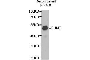 Western blot analysis of extracts of Recombinant protein cell lines, using BHMT antibody.
