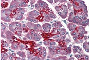 Human Pancreas (formalin-fixed, paraffin-embedded) stained with KRT19 antibody ABIN396942 at 10 ug/ml followed by biotinylated anti-mouse IgG secondary antibody ABIN481714, alkaline phosphatase-streptavidin and chromogen. (Cytokeratin 19 抗体)