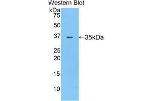 Western blot analysis of the recombinant protein. (AZGP1 抗体  (AA 18-296))