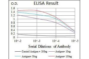 Black line: Control Antigen (100 ng), Purple line: Antigen(10 ng), Blue line: Antigen (50 ng), Red line: Antigen (100 ng), (PDX1 抗体)