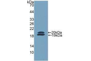 Western blot analysis of recombinant Mouse FCN2. (Ficolin 2 抗体  (AA 97-254))
