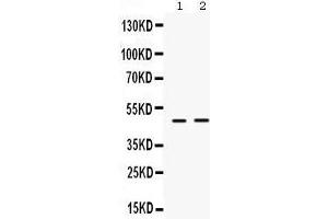 Western Blotting (WB) image for anti-Inhibitor of Growth Family, Member 1 (ING1) (AA 192-223), (Middle Region) antibody (ABIN3042467) (ING1 抗体  (Middle Region))