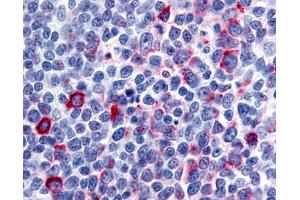 Anti-CCR8 antibody IHC of human tonsil, germinal center. (CCR8 抗体  (N-Term))