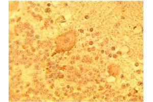 Immunohistochemical staining of normal human brain tissue using DEGS1 Antibody at 15 µg/ml. (DEGS1 抗体)