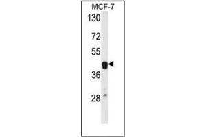 Western blot analysis of ETS2 Antibody (Center) in MCF-7 cell line lysates (35ug/lane). (ETS2 抗体  (Middle Region))