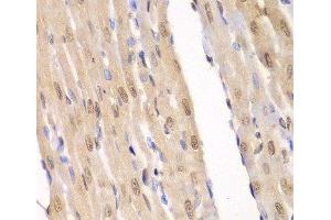 Immunohistochemistry of paraffin-embedded Rat heart using LIG3 Polyclonal Antibody at dilution of 1:100 (40x lens). (LIG3 抗体)