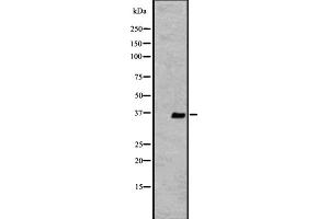 Western blot analysis of extracts from K562 , using OR2V2 antibody. (OR2V2 抗体  (Internal Region))
