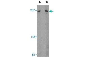 Western blot analysis of ARHGEF17 in Jurkat Cell lysate with ARHGEF17 polyclonal antibody  at (A) 1 and (B) 2 ug/mL .