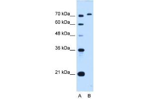 GPAA1 antibody used at 0. (GPAA1 抗体)