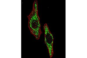 Fluorescent image of  cells stained with HSPD1 (Center) antibody.