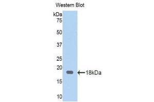 Western Blotting (WB) image for anti-serpin Peptidase Inhibitor, Clade A (Alpha-1 Antiproteinase, Antitrypsin), Member 6 (SERPINA6) (AA 280-405) antibody (ABIN1174372) (SERPINA6 抗体  (AA 280-405))