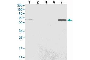 Western blot analysis of Lane 1: RT-4, Lane 2: U-251 MG, Lane 3: Human Plasma, Lane 4: Liver, Lane 5: Tonsil with C6orf190 polyclonal antibody . (THEMIS 抗体)