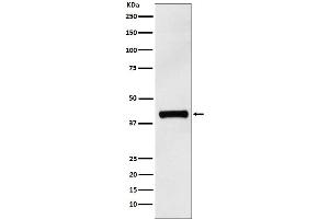 Western blot analysis of IL12 p40 expression in Human IL12 p40 recombinant protein.