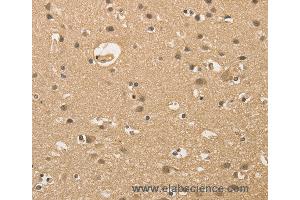 Immunohistochemistry of Human brain  using ALDH8A1 Polyclonal Antibody at dilution of 1:30 (ALDH8A1 抗体)