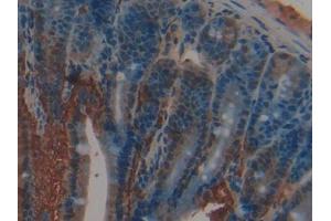Immunohistochemistry (IHC) image for anti-Retinol Binding Protein 2, Cellular (RBP2) (AA 1-134) antibody (ABIN1078478)