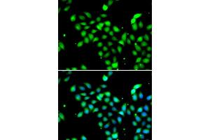 Immunofluorescence analysis of  cells using METTL13 antibody (ABIN6131842, ABIN6143755, ABIN6143757 and ABIN6216265). (METTL13 抗体  (AA 430-699))