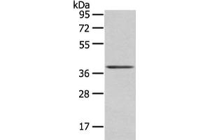 Gel: 8 % SDS-PAGE, Lysate: 40 μg, Lane: Mouse brain tissue, Primary antibody: ABIN7193059(WNT10A Antibody) at dilution 1/200 dilution, Secondary antibody: Goat anti rabbit IgG at 1/8000 dilution, Exposure time: 10 seconds (Protein Wnt-1 (WNT1.L) 抗体)