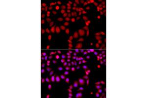 Immunofluorescence analysis of A549 cell using ARHGEF9 antibody. (Arhgef9 抗体)
