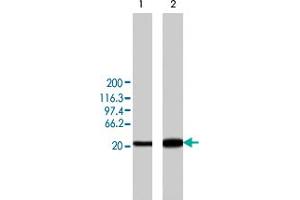 Western blot analysis of min6 cells overexpressing rat Camk2d, using Camk2d polyclonal antibody . (CAMK2D 抗体)