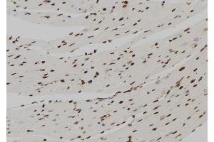 ABIN6277568 at 1/100 staining Mouse heart tissue by IHC-P. (FBP1 抗体  (Internal Region))