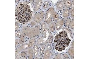 Immunohistochemical staining of human kidney with IL17RE polyclonal antibody  shows strong cytoplasmic and membranous positivity in glomeruli at 1:50-1:200 dilution. (IL17RE 抗体)
