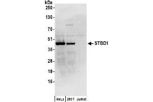 anti-Starch Binding Domain 1 (STBD1) (AA 75-125) antibody