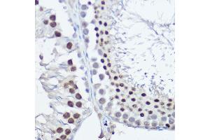 Immunohistochemistry (IHC) image for anti-Fanconi Anemia, Complementation Group C (FANCC) (AA 319-558) antibody (ABIN3022594)