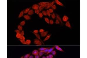Immunofluorescence analysis of HeLa cells using NRF2 Polyclonal Antibody at dilution of 1:100. (NRF2 抗体)