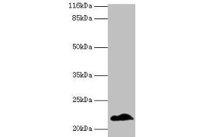 Western blot All lanes: NDUFB5 antibody at 2 μg/mL + U251 whole cell lysate Secondary Goat polyclonal to rabbit IgG at 1/10000 dilution Predicted band size: 22, 16 kDa Observed band size: 22 kDa (NDUFB5 抗体  (AA 94-189))