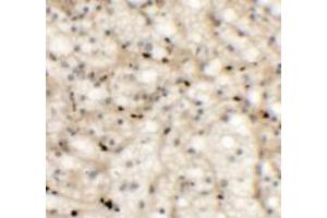 Immunohistochemistry (IHC) image for anti-NK2 Homeobox 6 (NKX2-6) (Middle Region) antibody (ABIN1031022) (NKX2-6 抗体  (Middle Region))