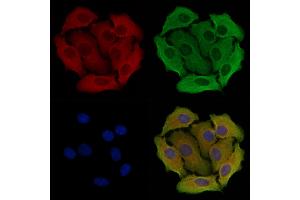 ABIN6258358 and ABIN6274562 staining Hela cells by IF/ICC.