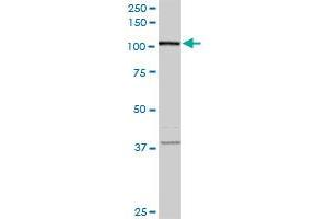 FLJ20097 monoclonal antibody (M01A), clone 2D11. (Syndetin/VPS50 抗体  (AA 862-964))