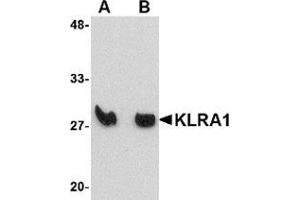 Western blot analysis of KLRA1 in mouse spleen tissue lysate with KLRA1 antibody at (A) 1 μg/ml and (B) 2 μg/ml. (KLRA1 抗体  (Center))