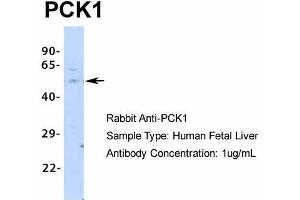 Host: Rabbit  Target Name: PCK1  Sample Tissue: Human Fetal Liver  Antibody Dilution: 1. (PCK1 抗体  (Middle Region))