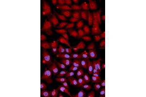 Immunofluorescence analysis of U2OS cells using MAP2K6 antibody (ABIN5971400). (MAP2K6 抗体)