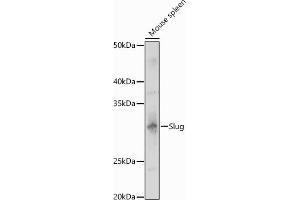 Western blot analysis of extracts of Mouse spleen, using Slug antibody (ABIN3021317, ABIN3021318, ABIN3021319 and ABIN6214866) at 1:1000 dilution. (SLUG 抗体  (AA 89-268))