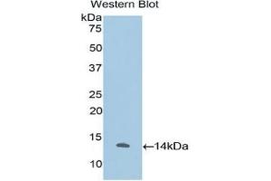 Detection of Recombinant IL33, Human using Polyclonal Antibody to Interleukin 33 (IL33) (IL-33 抗体)