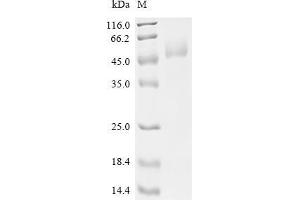 PTK2 Protein tyrosine Kinase 2 (PTK2) (AA 685-1052) protein (His tag)