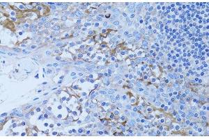 Immunohistochemistry of paraffin-embedded Human tonsil using HADH Polyclonal Antibody at dilution of 1:100 (40x lens). (HADH 抗体)